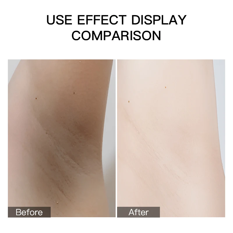 Body Whitening Armpit Underarm Softening Cream For Sensitive Areas