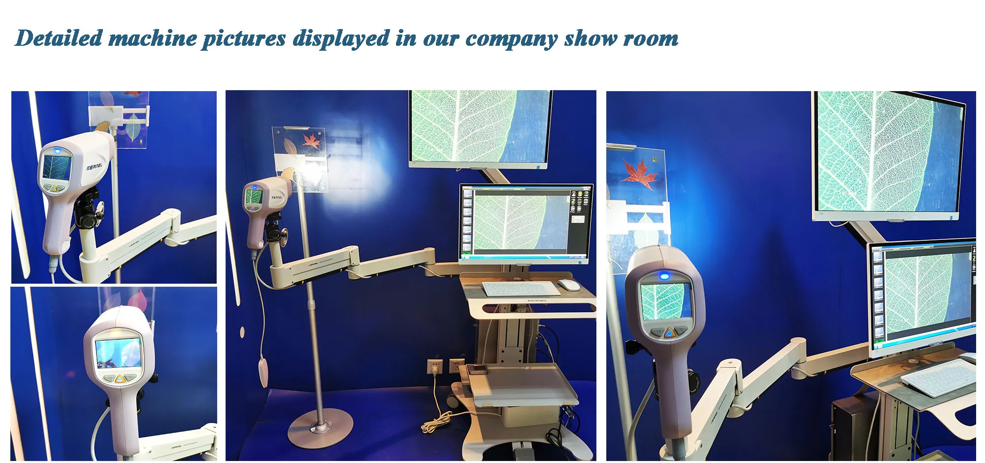 KN-2200 Series Double screen HD Digital Colposcope Self Examination Auto Video Handheld