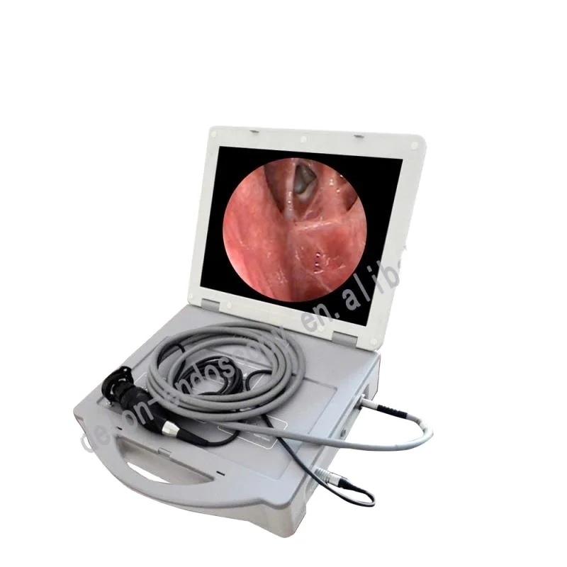 DELON SD card portable CCD camera system delon endoscopy