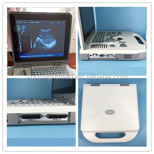 Hospital used Medical Equipment Portable veterinary animal ultrasound device