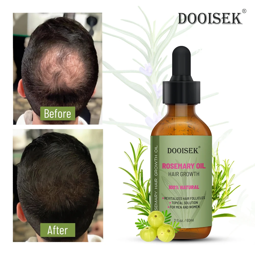 Private Label Natural Rosemary Nourishing Serum Anti Hair Loss Care Treatment Products for Strengthening Scalp Fast Growth Oil