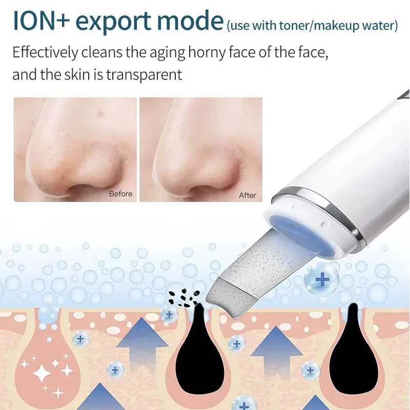 Customized Logo Ultrasonic Skin Scrubber Facial Scrubber Blackhead Remover Pore Cleaner Skin Spatula Skin Scraper with 4 Modes