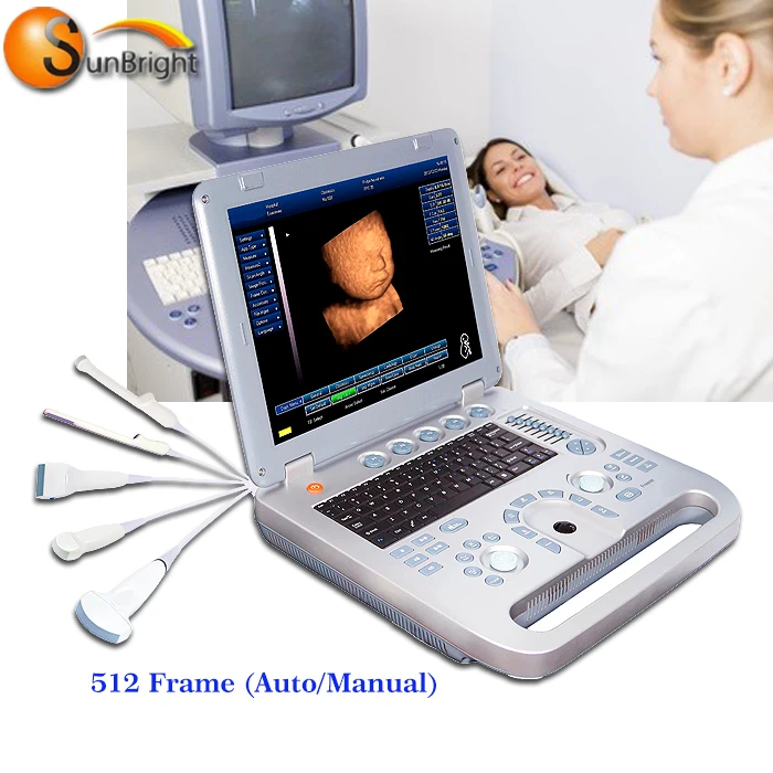 cheap manufacture price ultrasound machine second hand brand new ultrasound