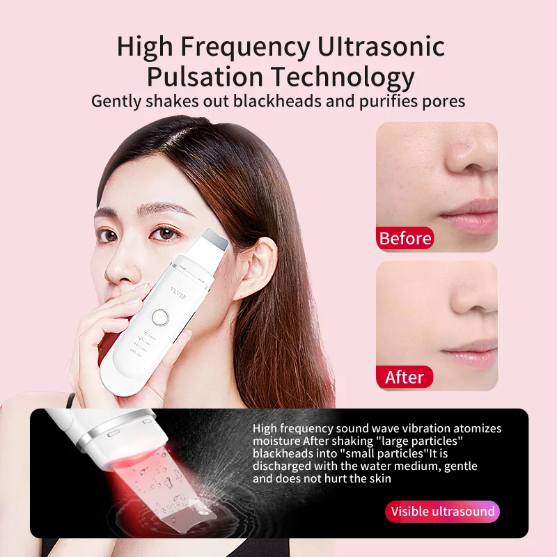 OEM & ODM Wholesale Supplierbeauty Machine Facial Ultrasonic Skin Scrubber Face Cleaning Shovel Peeling Red & Blue Light