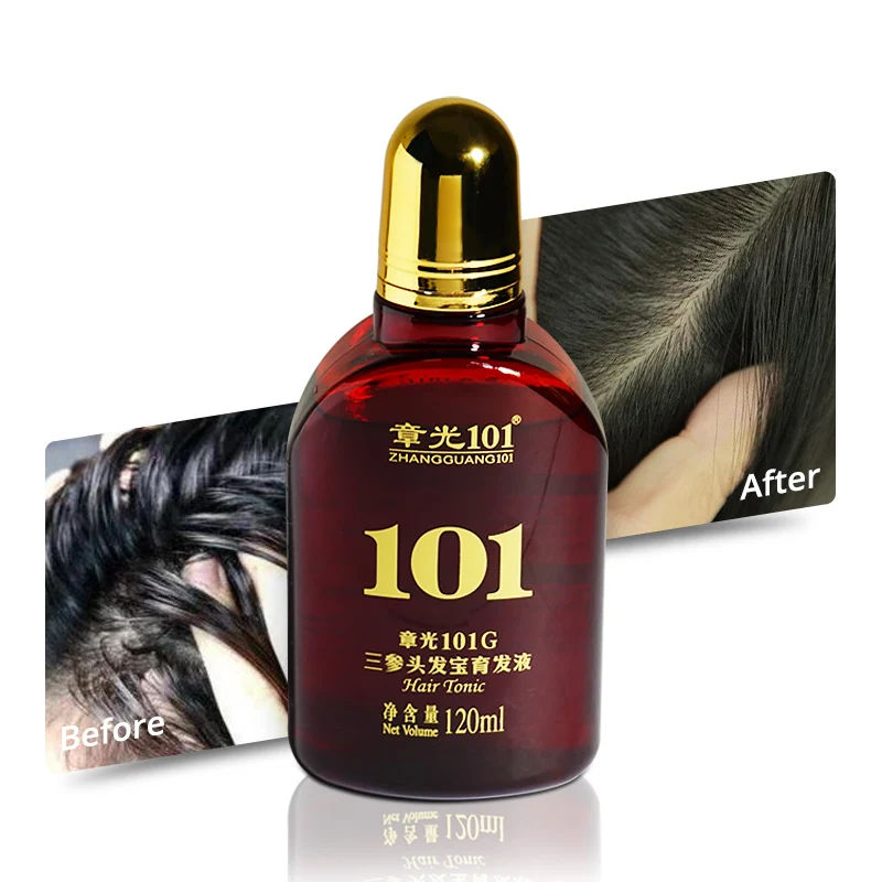 Private Label High Quality Oil Control Anti Hair Loss Hair Growth Serum
