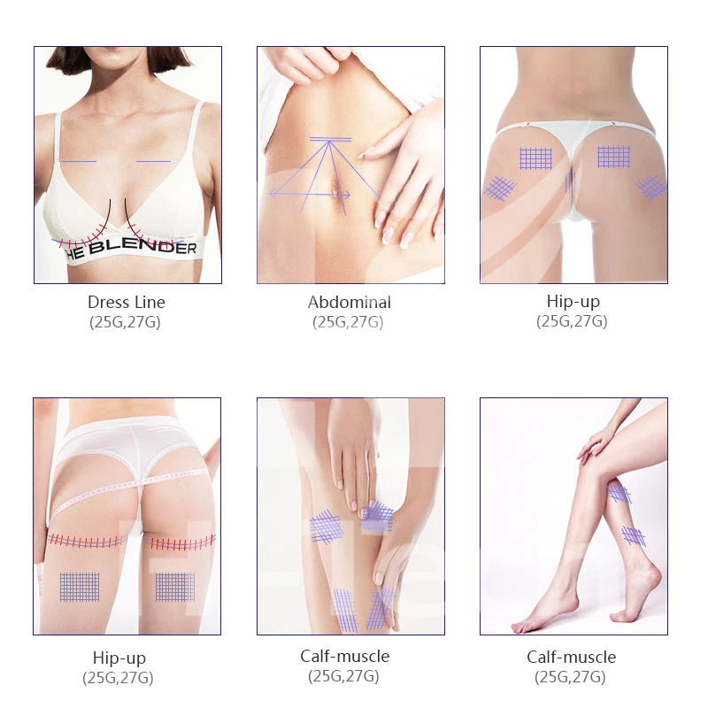 Wholesale Charmost Fishbone Pdo/pcl Thread 18g 100mm Cannula Barbs Thread Lift Face Pdo Surgical Suture Needle