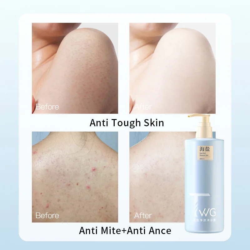 TWG Anti Mite Body Wash Gel Anti Acne Body Cleanser  Mineral Amino Acid Sea Salt  Anti Mite Shower Gel