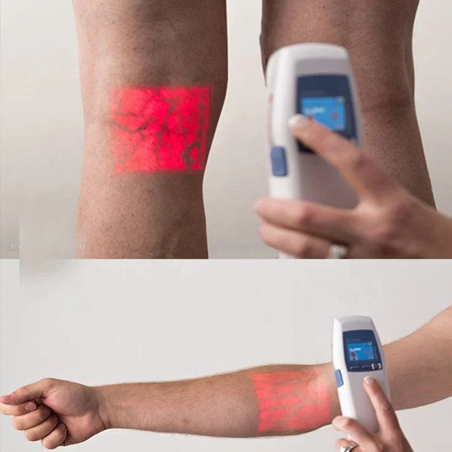 
High Quality Portable Hospital Clinic Infrared Accu Vein Finder Vein Detector 