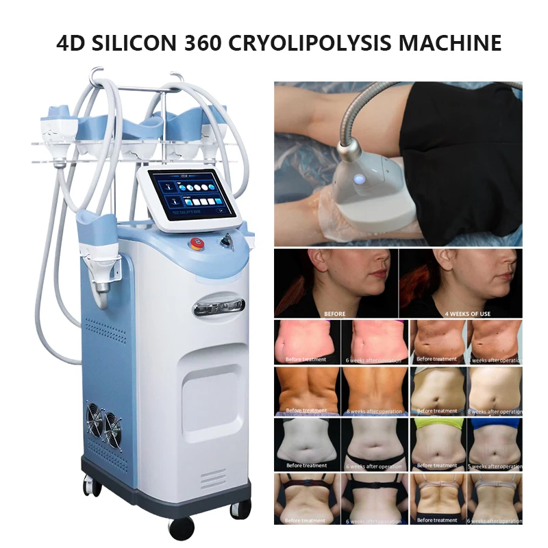 Professional cryo machine 4 handles Cryolipolysis cryo lose weight 360 degree fat freezing cryolipolysis body slimming machine