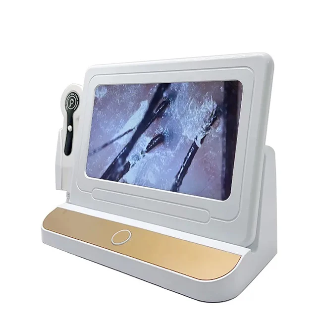 professional 10 inch screen scalp hair follicle detector SA-S19 hair follicle analyzer