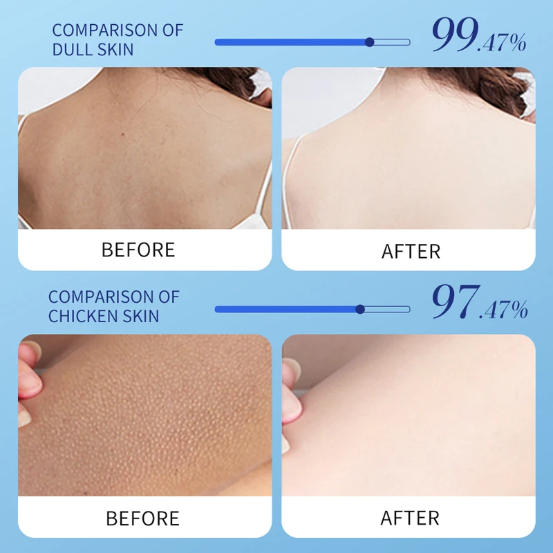 OEM BIOAQUA private label wholesale Vitamin E uric acid moisturizing anti cracking exfoliating dead skin body lotion cream