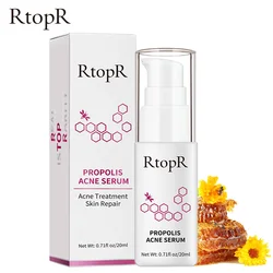 RtopR Propolis Repair Acne Brightening Serum Acne Scar Spots Cleaning Serum Shrink Pores Eliminates Acne Treatment Oil control