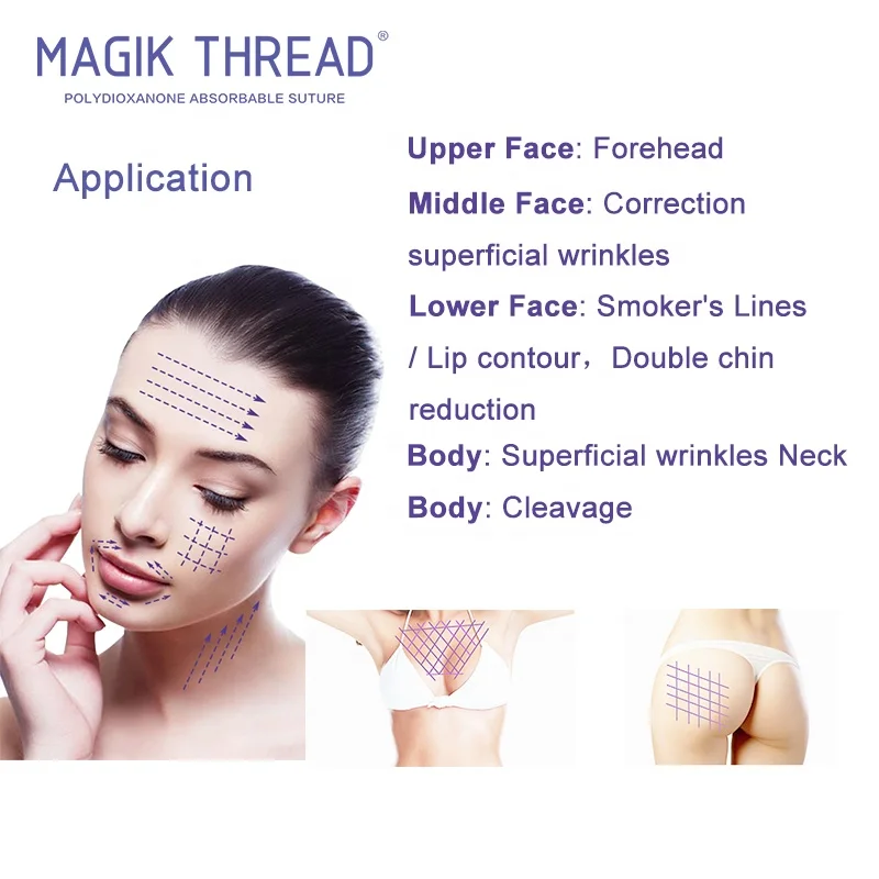 Mono 27G 50MM Face lifting tightening thread embedding threading face lift