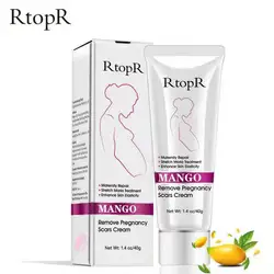 Mango Remove Pregnancy Scars Acne Cream Stretch Marks Treatment Maternity Repair Anti-Aging Anti Winkles Firming Body Cream