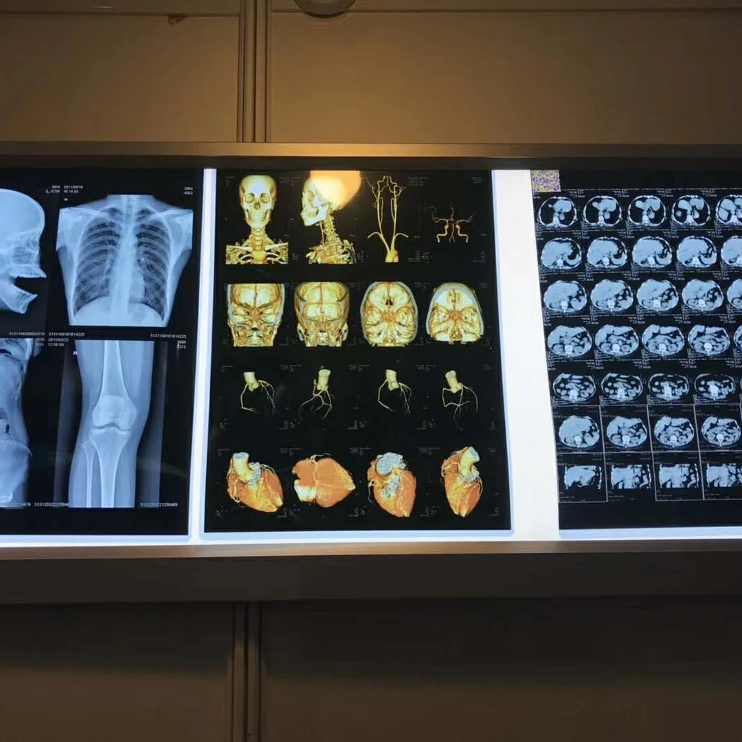 Blue Inkjet Medical Dry Film CT DR MRI X Ray Blue Transparent Film