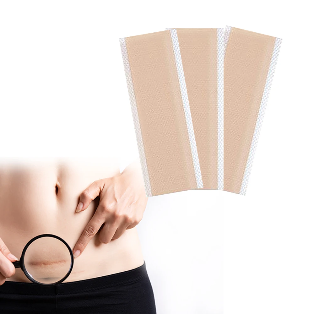 Reusable and Washable Removal Silicone Scar Tape for Softening and Flattening Scars