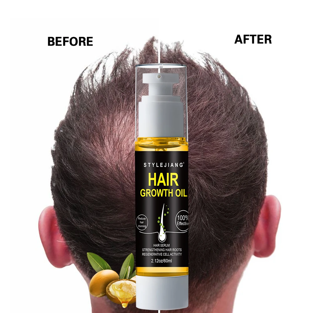 Factory OEM&ODM Anti-dandruff Moisturizing Hair Growth Oil for Men Hair Growth Oil Hair Scalp Care Products