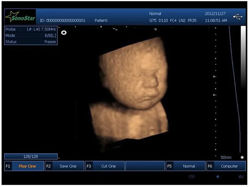 
SS-9 Portable Laptop Color Doppler Ultrasound Machine Scanner Convex Linear Transvaginal Probe 