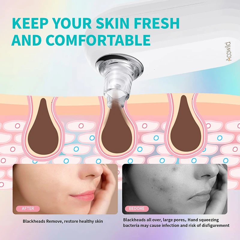 Unique Woodpecker Design 42 Celsius Degree Electric Small Heating Blackhead Remover Vacuum Pore Cleaner