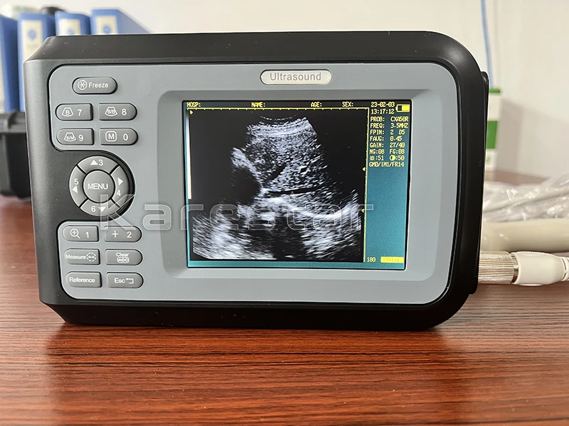 5.5 Inches Portable Farm Use Veterinary Full Digital Handheld Ultrasound Scanner Vet Ultrasound
