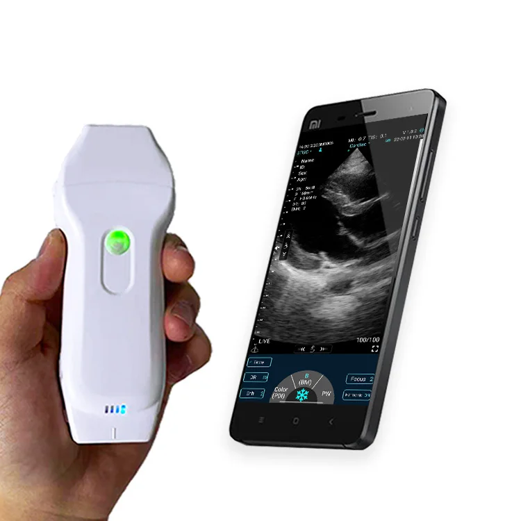 High Quality New Technology Handhold USB&WiFi 3 in 1 Dual head Color Doppler Ultrasound