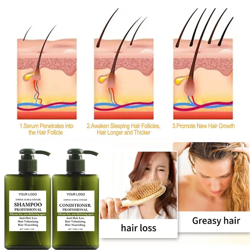 Shampoo Hair Care Anti-Loss Control Oil 100% Natural Amino Acid Ginger Baby And Pregnant Shampoo And Conditioner Hair Care Sets