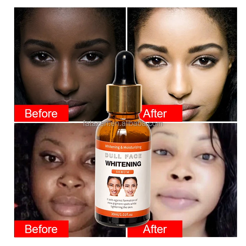 Private Label Anti-Aging Remedy Arbutin Facial Whitening Moisturizer Vegan Essential Oil Aceite Esencial Face Care Serum