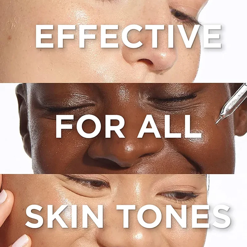 Private Label Nicotinamide Organic Face Skin Lightening Whitening Anti-Aging Face Cream 1kg Bulk