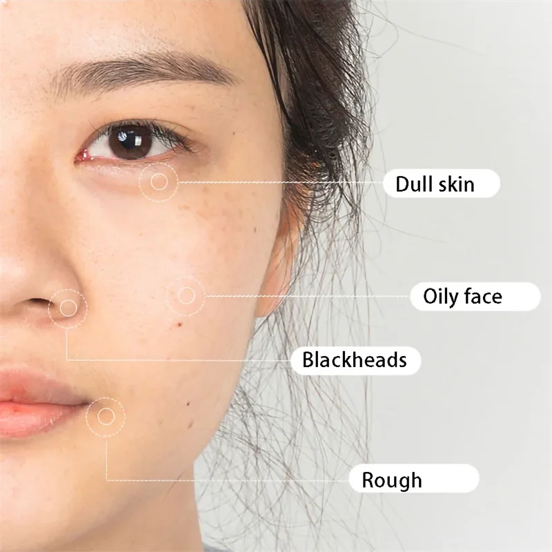 23G Customized Logo Private Label Facial Wash Salicylic Acid Face Wash Facial Cleanser For Sensitive Skin