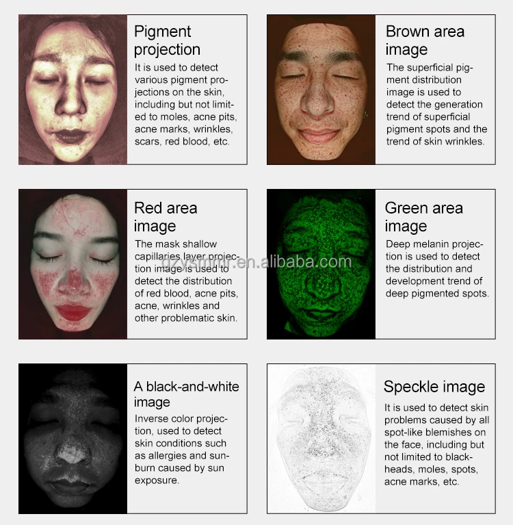 Portable AI 3D Vertical Screen Skin Analyzer Machine 4K Ultra HD Large-Sensor Camera Home Use Facial Skin Scanner Diagnostic EU