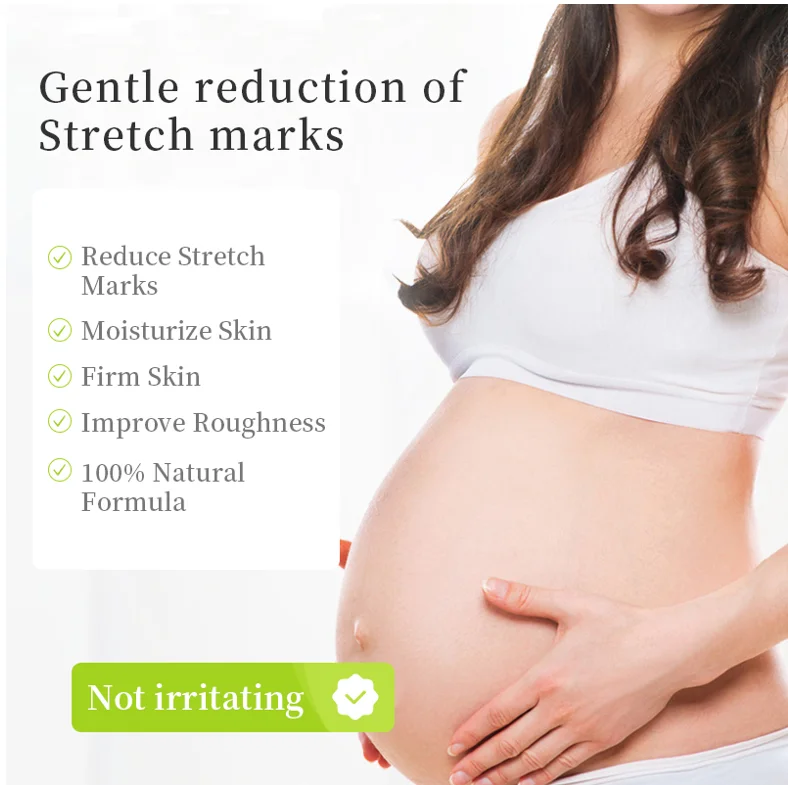  Private Label Stretchmark Remover Cream Natural Organic Body Scar Repair Slack Line Pregnancy Abdomen Anti Stretch Mark