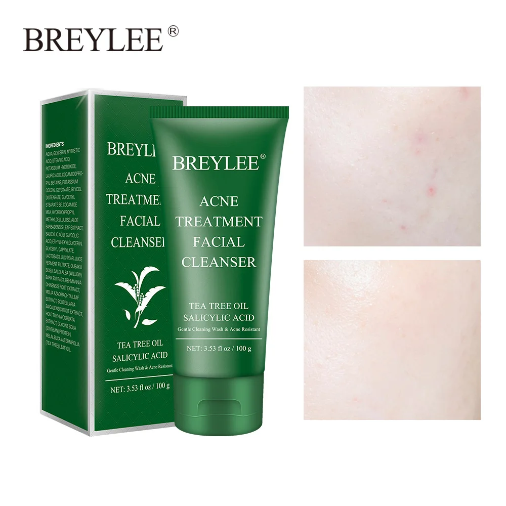 BREYLEE Tea Tree Oil Salicylic Acid Facial Cleanser Remove Acne Oil Control Facial Cleaning Cream Acne Treatment Facial Cleanser