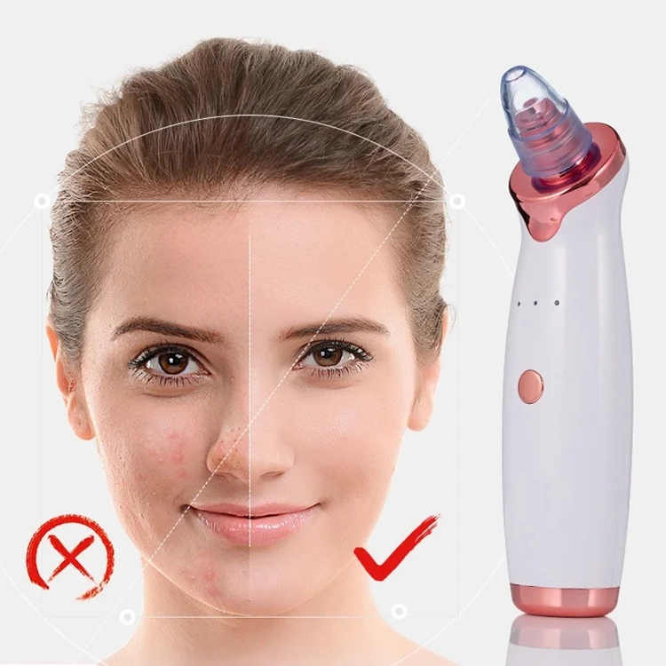 Microcrystalline Liposuction Vacuum Blackhead Remover Apparatus Electric Artifact Facial Beauty Pore Cleaner