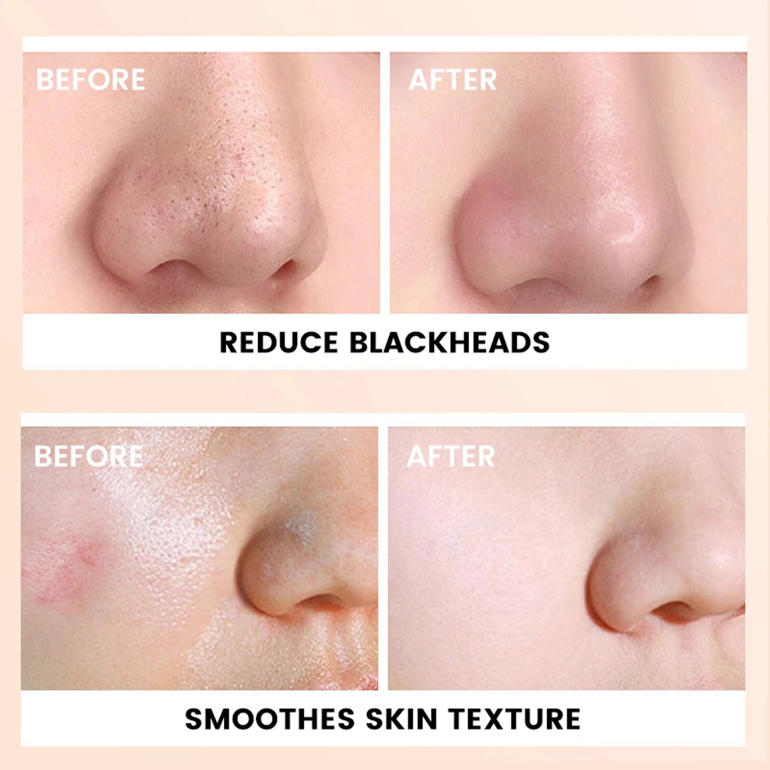 Customized Logo Acid Pore Blackhead Remove Whitening Facial Cleanser Skin Scrub Exfoliating Peeling Gel Skincare Face Wash Scrub