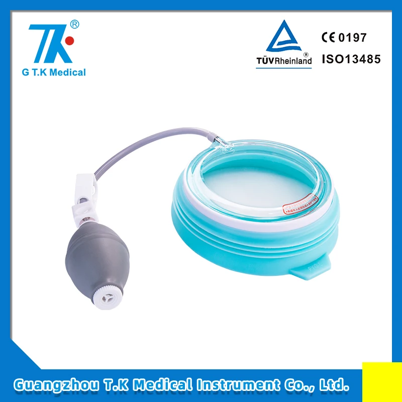 Suction Cup Vacuum Bell Non-Surgical Option to Treat Pectus Excavatum