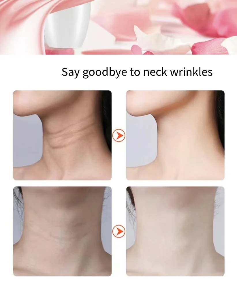 Wholesale Skin Tightening Face-lifting Instrument Neck Wrinkle Removal Devices