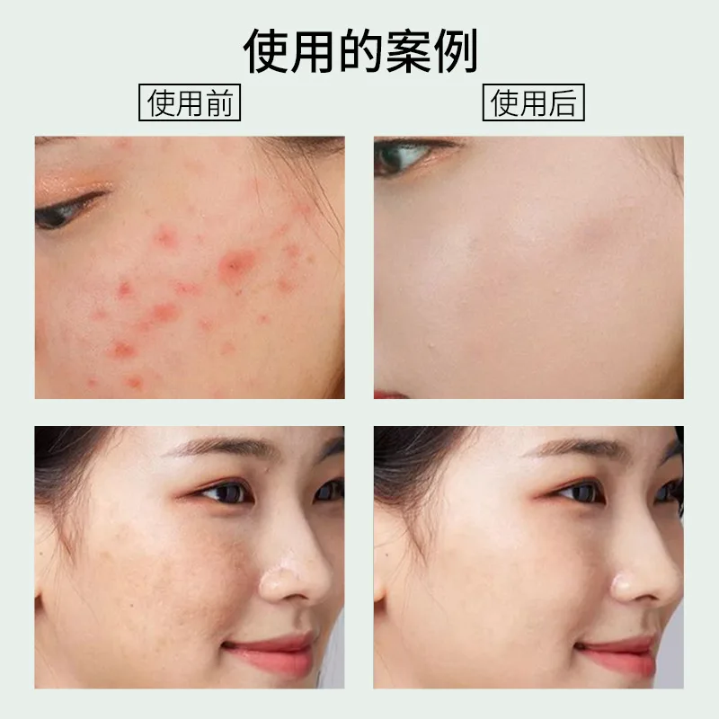 Sparse base water stinky water discharge lead and mercury to improve hormone face sensitive muscle light spot stinky water beaut