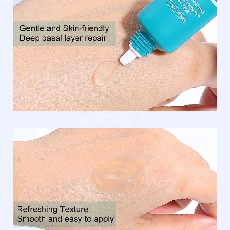 30g Acne Removal Freckle Cream Shrink Pores Whitening Moisturizing Oil Control Acne Cream Skin Care Treatment Face Cream