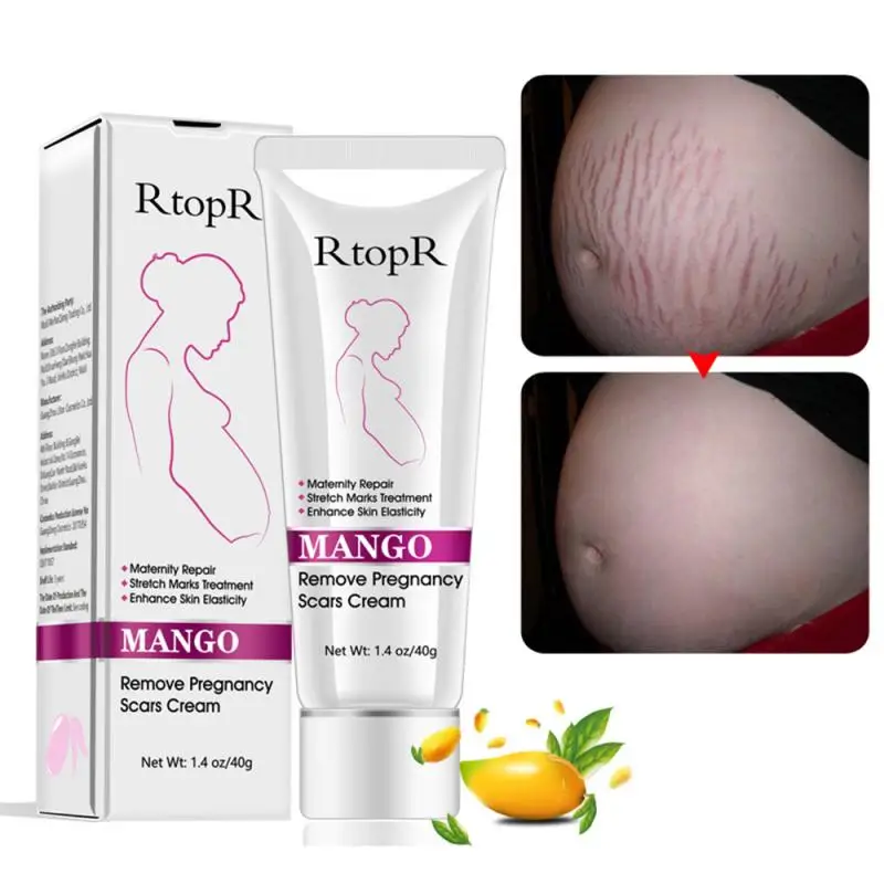 Private Label Best Rtopr 100% Natural Snail  Mango Anti Removal Stretch Mark Cream