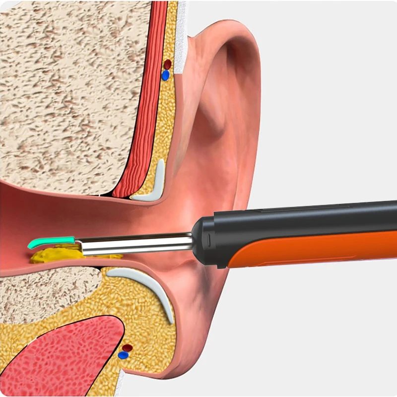 Wireless WiFi Ear Pick Otoscope Camera Borescope Luminous Ear Wax Cleaning Teeth Oral Inspection Health Care Ear Cleaner