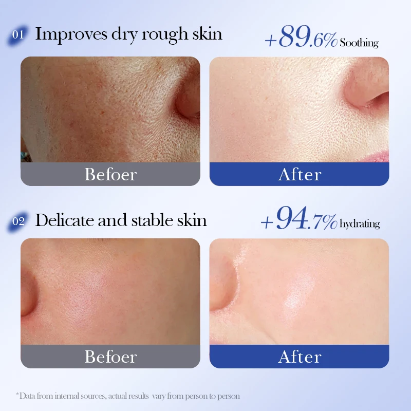 FAYANKOU Beauty Product Blueberry Soothing Beauty Facial Mask Soothing And Nourish Repair Moisturizing Whitening Brightening