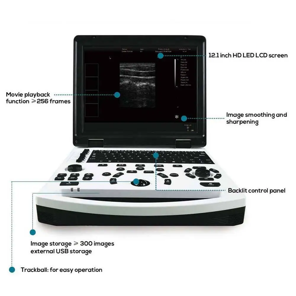 Vet 12.1 inch HD LED LCD screen For human and Animal