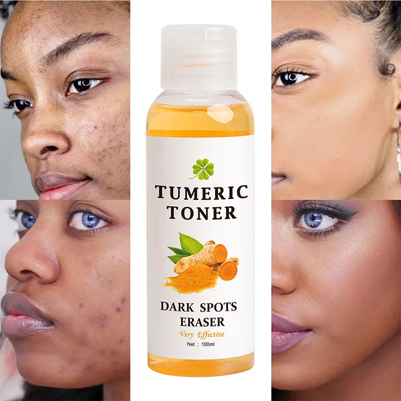 Wholesale Face Care Toner Deep Hydration Refreshing Brightening Dark Spots Eraser Turmeric Toner
