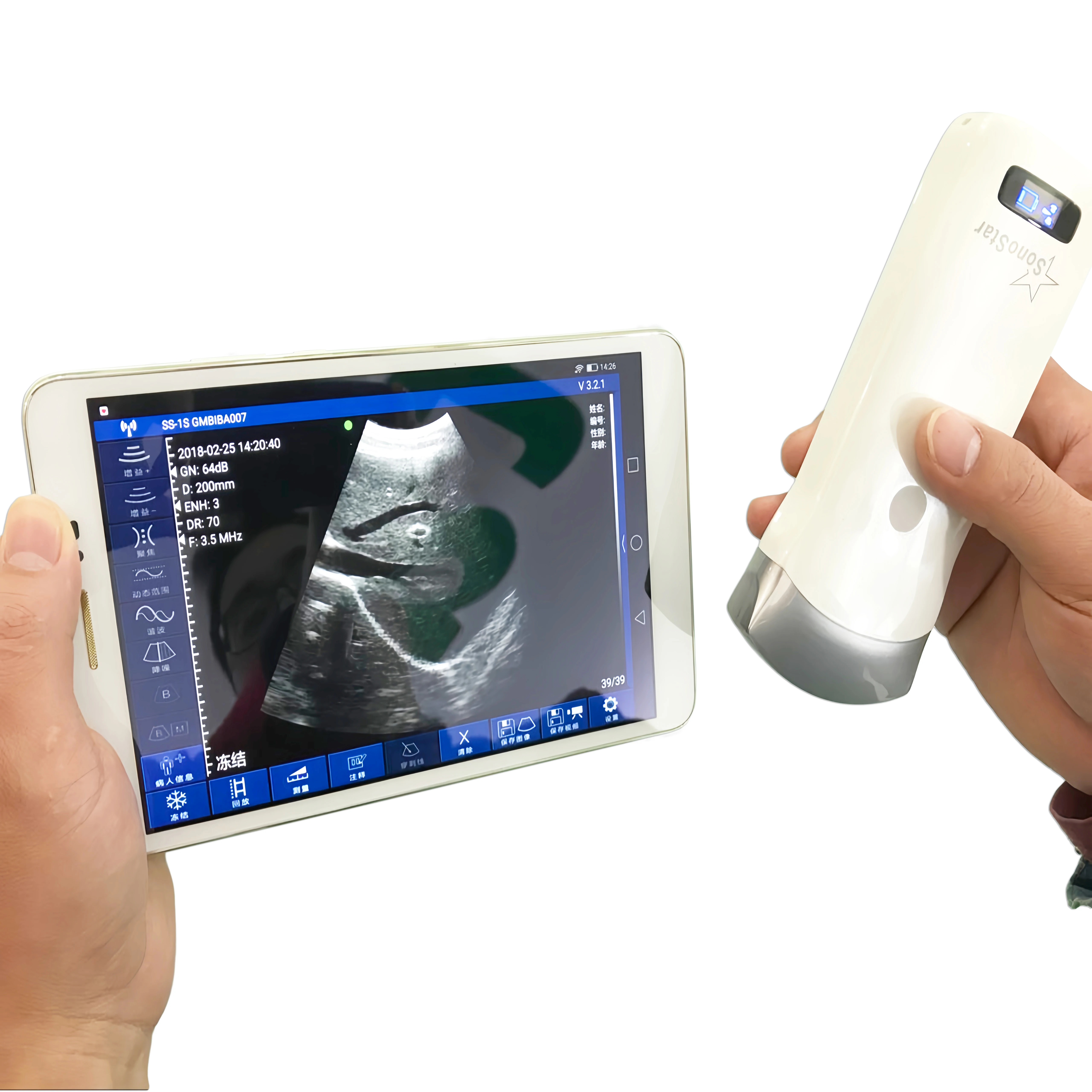 3 In 1 Medical Electronic Convex Array Scanning Phone Tablet Computer iOS Android Windows Wireless Ultrasound Probe Scanner