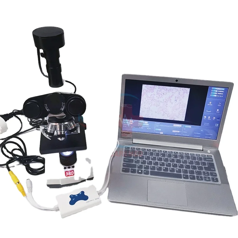 Hc-B028V Upgraded Human Sperm Analyzer Machine Canine Semen Analyzer Price