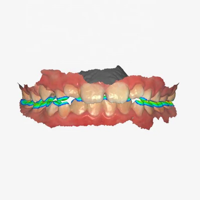 Стоматологическое оборудование XANGTECH, цифровой интраоральный 3d-сканер