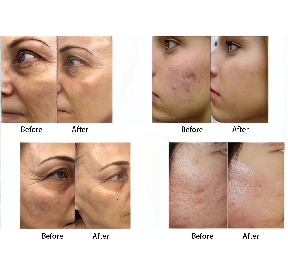 Beauty Salon Use Professional Beauty Machine