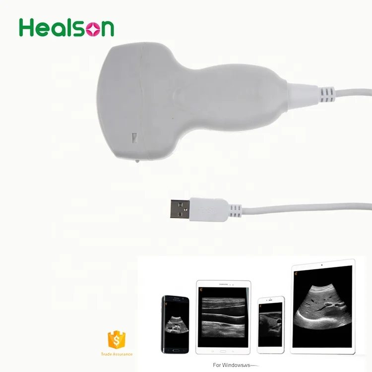 
Healson UP20 cheapest USB portable ultrasound machine /usb ultrasound probe 
