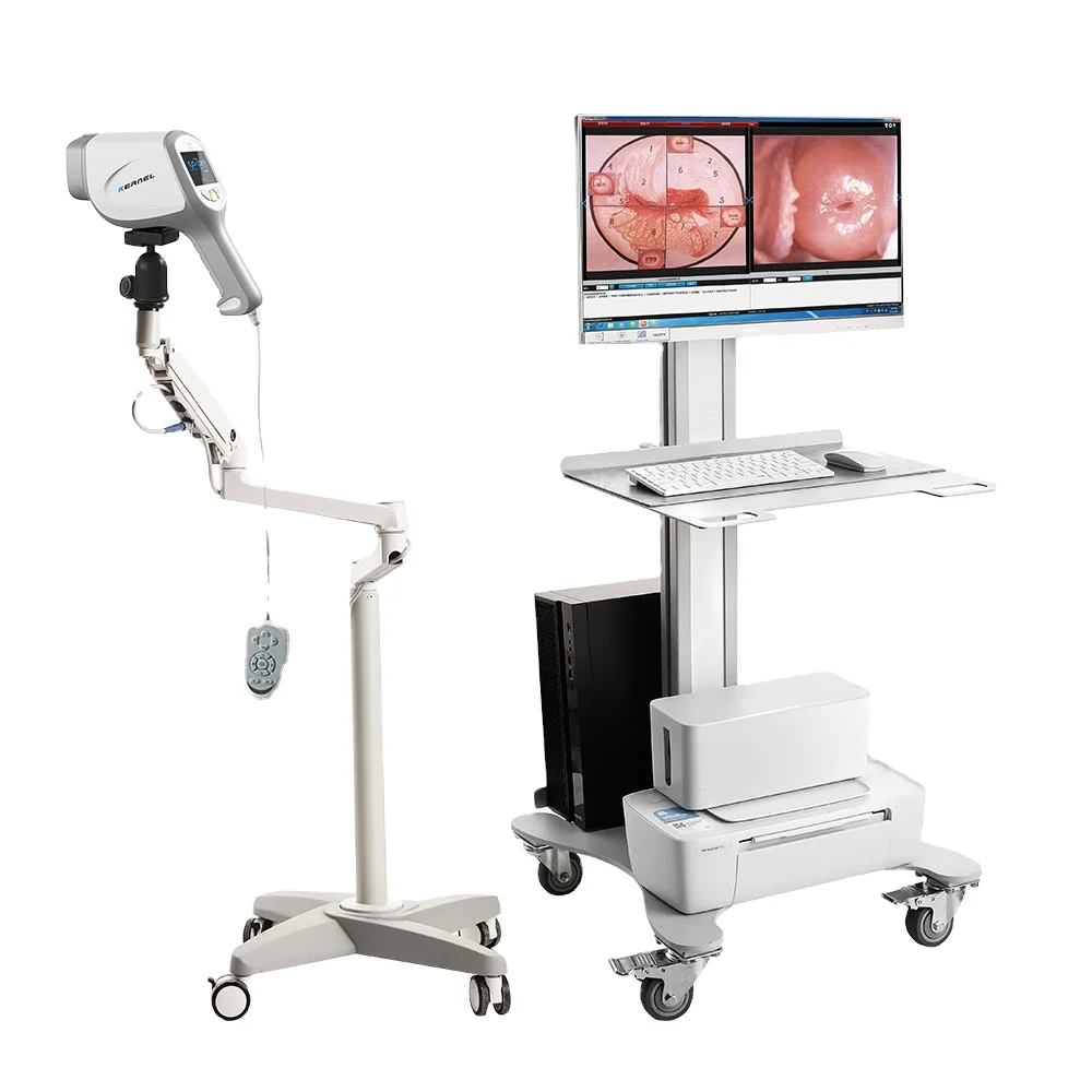 Kernel CE approved Electronic Portable Colposcope Gynecology Examination Machine for Colposcopy Video Colposcope