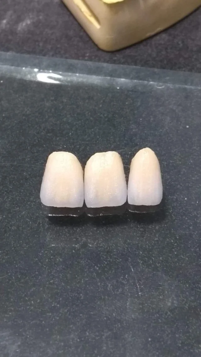 Popular Product Dental Consumable High Quality Alloy NB NP CC SOFT PS TS Used For Dental Lab